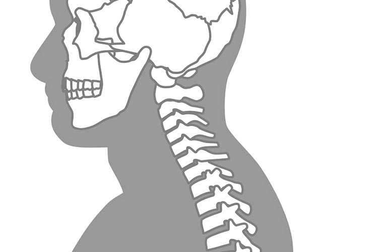 変形性頚椎症のイメージ写真